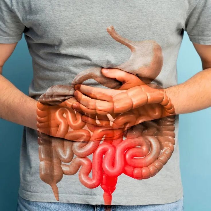 CYNTRIX™ - GUT SUPPORT CAPSULE